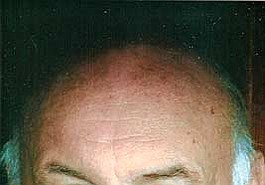 Lead photo