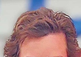 Lead photo